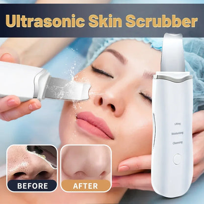 Profissional Não Ultrassônico Facial Skin Scrubber Ion Deep Face Limpeza Peeling Recarregável Dispositivo de Cuidados com a Pele Instrumento de Beleza