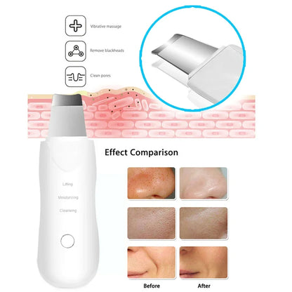 Profissional Não Ultrassônico Facial Skin Scrubber Ion Deep Face Limpeza Peeling Recarregável Dispositivo de Cuidados com a Pele Instrumento de Beleza